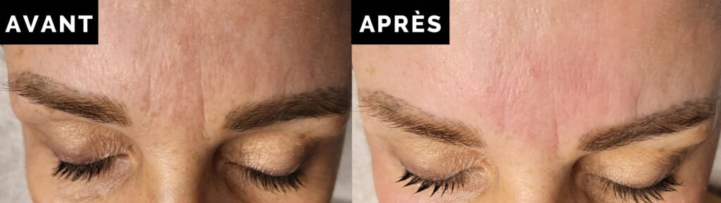 Visuel-Avant-Apres-V2