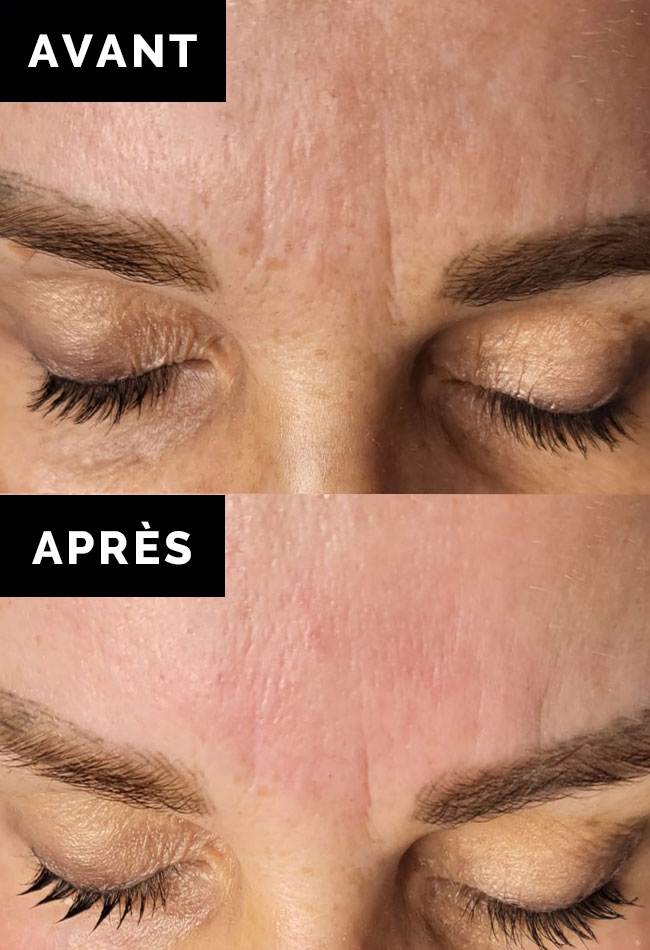 Visuel-Avant-Apres-V2-Mobile